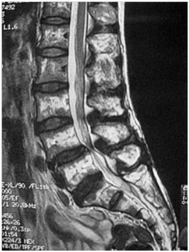 脊椎脊髄外科HP写真20131029⑦
