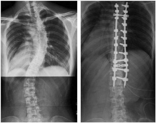 脊椎脊髄外科HP写真20131029⑪