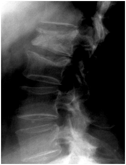 脊椎脊髄外科HP写真20131029⑫