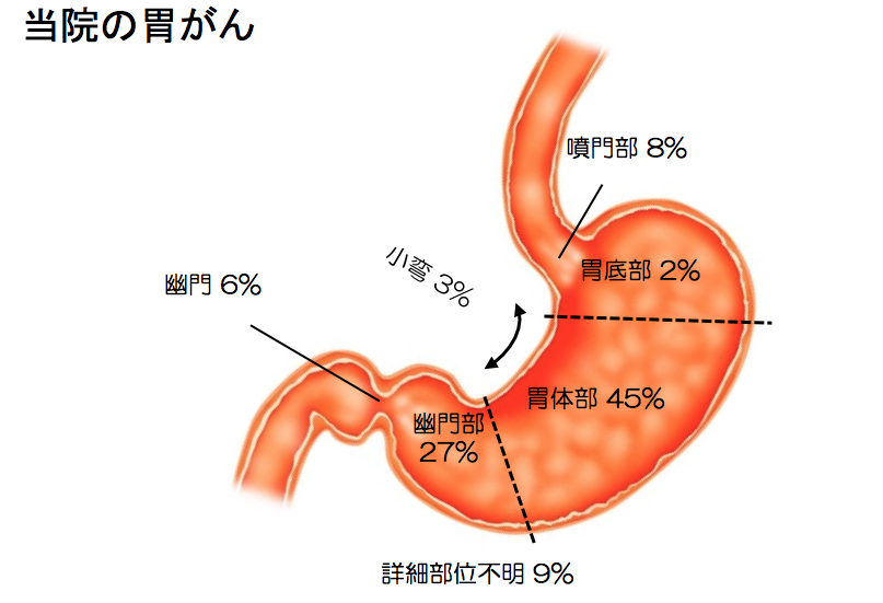 いがん1