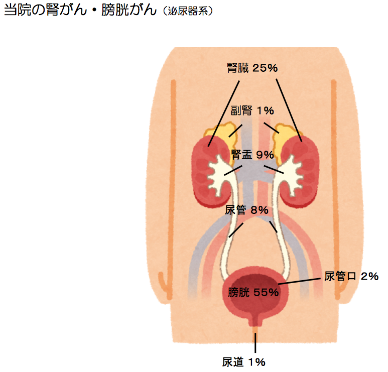 腎がん・膀胱がん